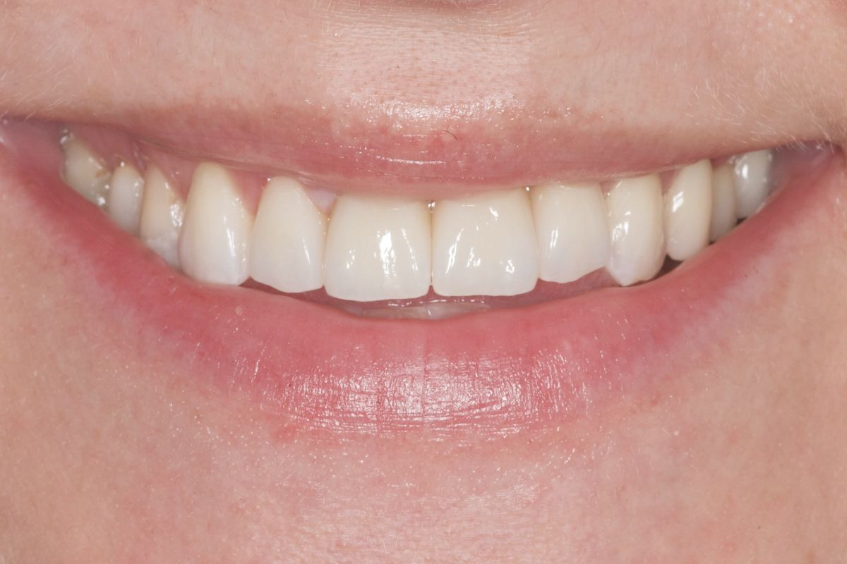 Before image